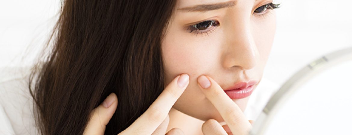 young woman squeeze her acne in front of the mirror; Shutterstock ID 503336257; Purchase Order: -